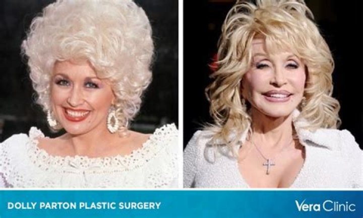 Has Dolly Parton Had Plastic Surgery? What Plastic Surgery Has Dolly Parton Had?